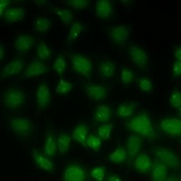 Anti-ALKBH8 Antibody