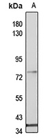 5-Lipoxygenase Rabbit Polyclonal Antibody