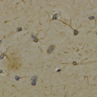 5-Lipoxygenase Rabbit Polyclonal Antibody
