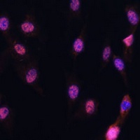5-Lipoxygenase Rabbit Polyclonal Antibody