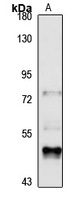 ALPL Rabbit Polyclonal Antibody