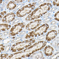 Anti-ALPL Antibody