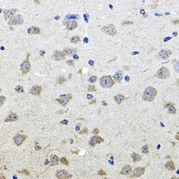 Anti-ALPL Antibody