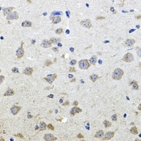 ALPL antibody