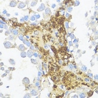 MIS Rabbit Polyclonal Antibody