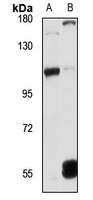 Angiomotin-L2 Rabbit Polyclonal Antibody