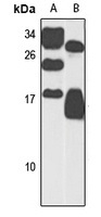ANAPC13 Antibody