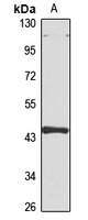 ANKH Rabbit Polyclonal Antibody