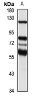 Sugen Kinase 288 Rabbit Polyclonal Antibody
