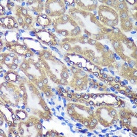 Anti-ANKLE2 Antibody