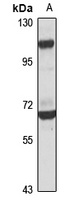 ANKRD44 Rabbit Polyclonal Antibody