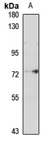 Acyloxyacyl Hydrolase Rabbit Polyclonal Antibody
