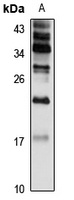AP1S1 Antibody