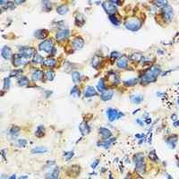 APOBEC3F Antibody