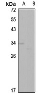 Apolipoprotein D Antibody