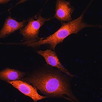 Anti-COPD Antibody