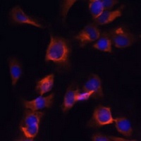 ARL13B antibody