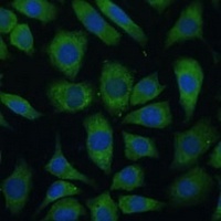 Anti-ARL3 Antibody