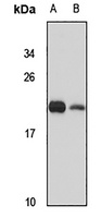 ARL4D Antibody
