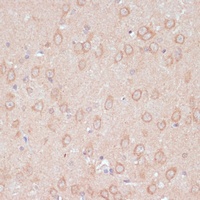 Anti-ARL4D Antibody
