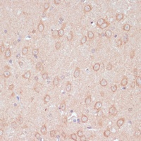 ARL4D antibody