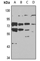 Arylsulfatase F Rabbit Polyclonal Antibody