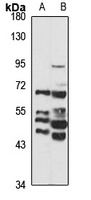 Arylsulfatase H Antibody