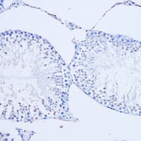 Anti-ARX Antibody