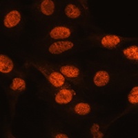 Anti-ARX Antibody