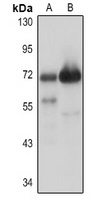 ASB-2 Rabbit Polyclonal Antibody