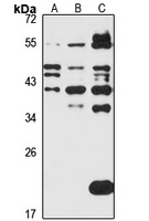 ASB-5 Rabbit Polyclonal Antibody