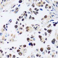 Anti-ASCL4 Antibody