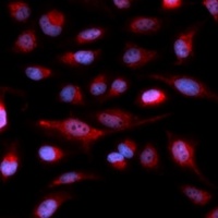 Anti-ASH2L Antibody