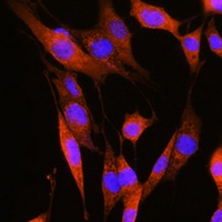 Anti-ASS1 Antibody