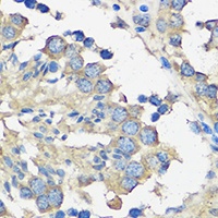 Anti-ASZ1 Antibody