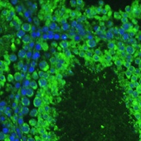 Anti-ASZ1 Antibody