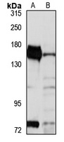ATP11C Rabbit Polyclonal Antibody