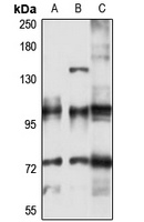ATP2A3 Rabbit Polyclonal Antibody