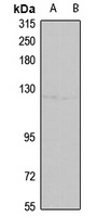 ATP2C1 Rabbit Polyclonal Antibody