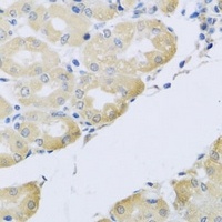 Anti-ATP2C1 Antibody