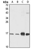 ATP5D Antibody