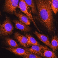 Anti-ATP5D Antibody