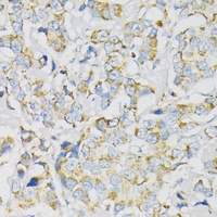 Anti-ATP5J Antibody