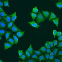 Anti-ATP5J Antibody