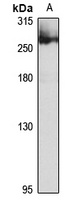 ATR Rabbit Polyclonal Antibody