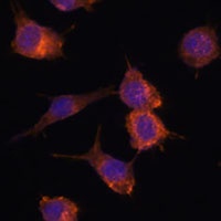 Anti-Advillin Antibody