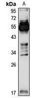 Azurocidin Rabbit Polyclonal Antibody