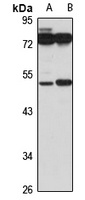 beta 3Gn-T3 Rabbit Polyclonal Antibody