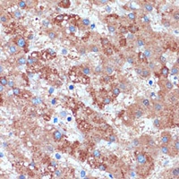 beta 3Gn-T3 antibody