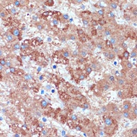 beta 3Gn-T3 Rabbit Polyclonal Antibody